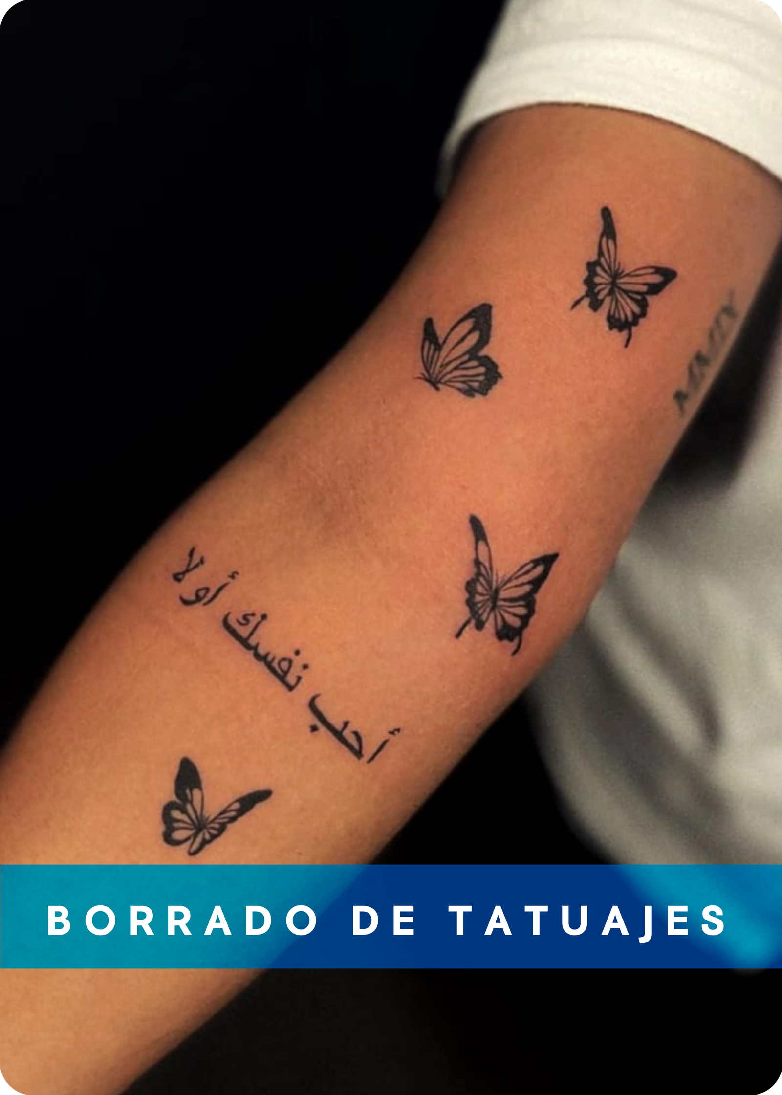 BORRADO DE TATUAJES