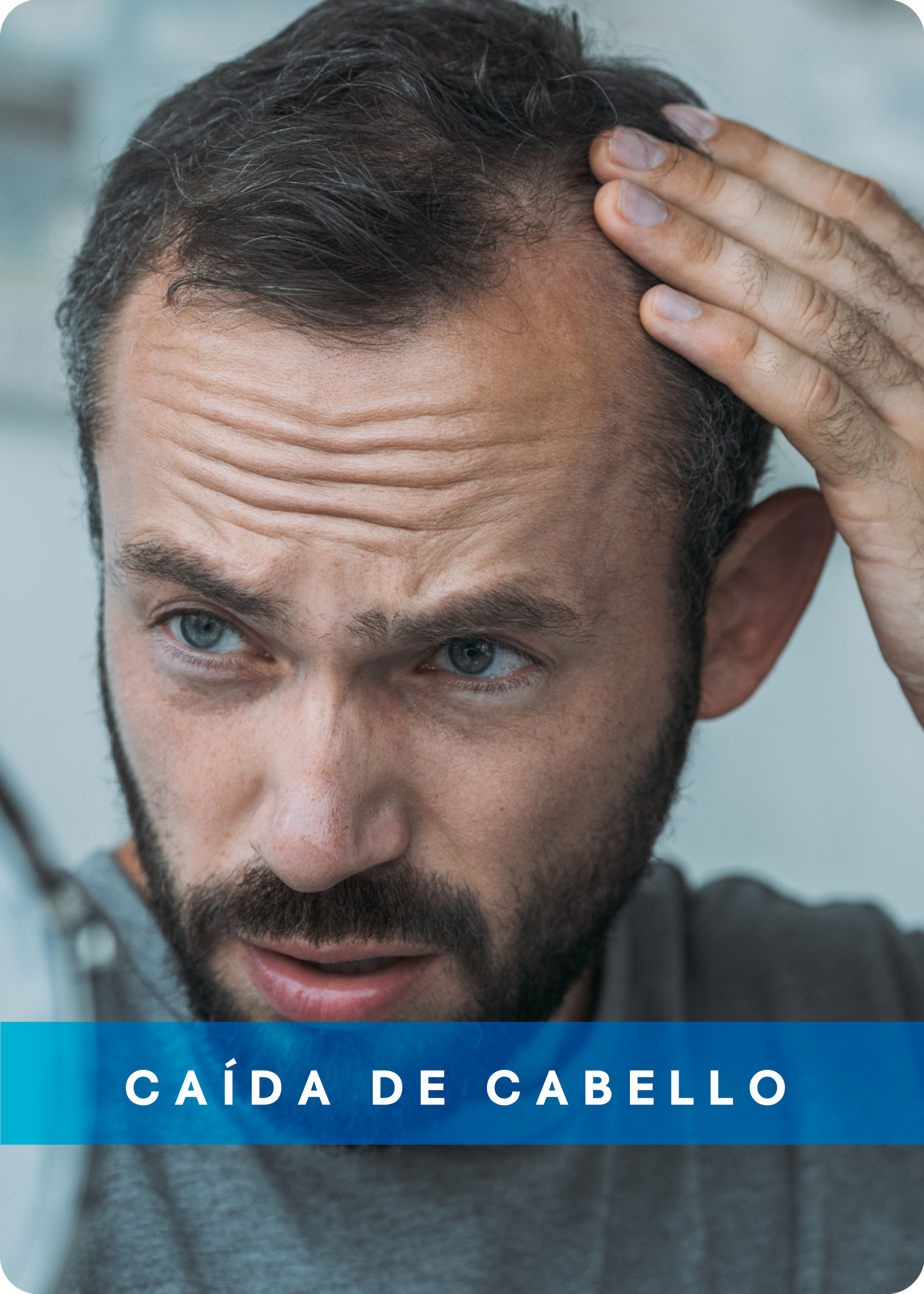 CAIDA DE CABELLO