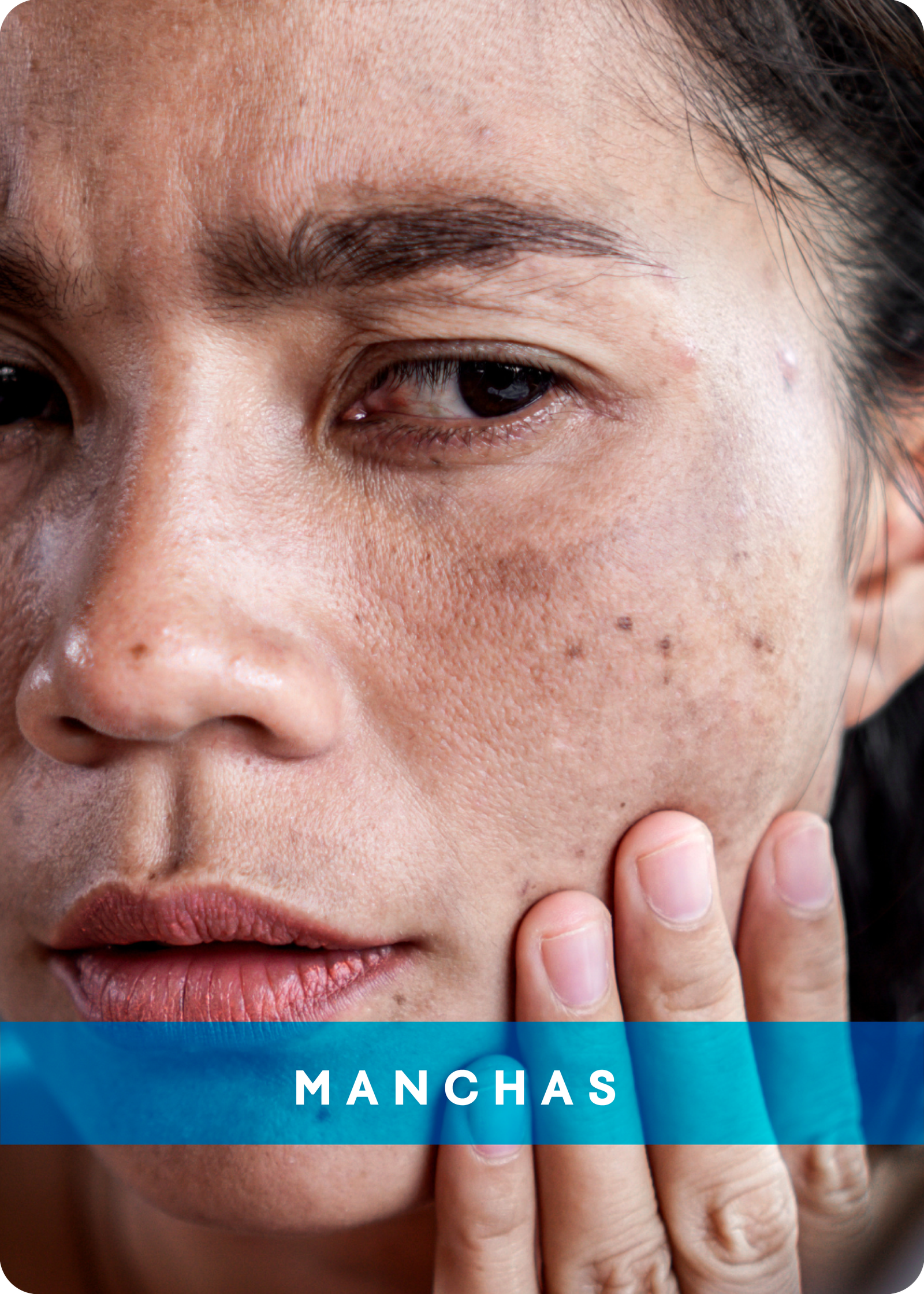 MANCHAS