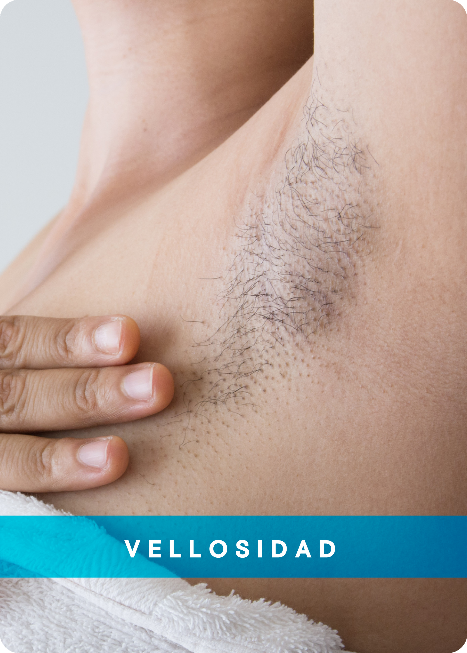 VELLOSIDAD