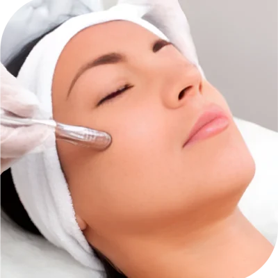 Microdermoabrasión